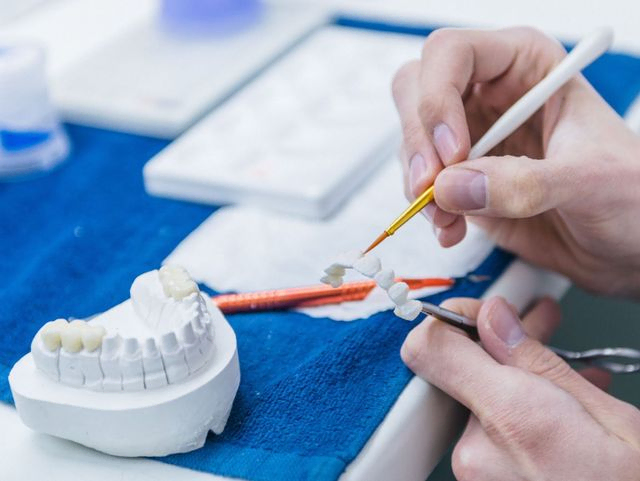 trabajando en implantes dentales